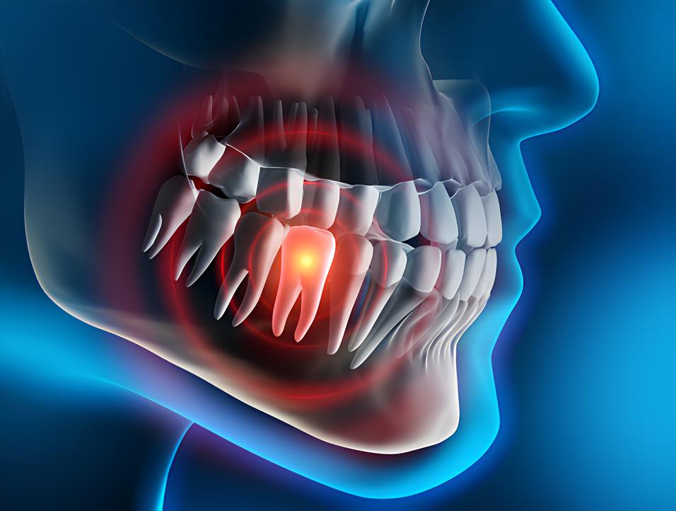 Teeth image - Emergency dentist Doncaster